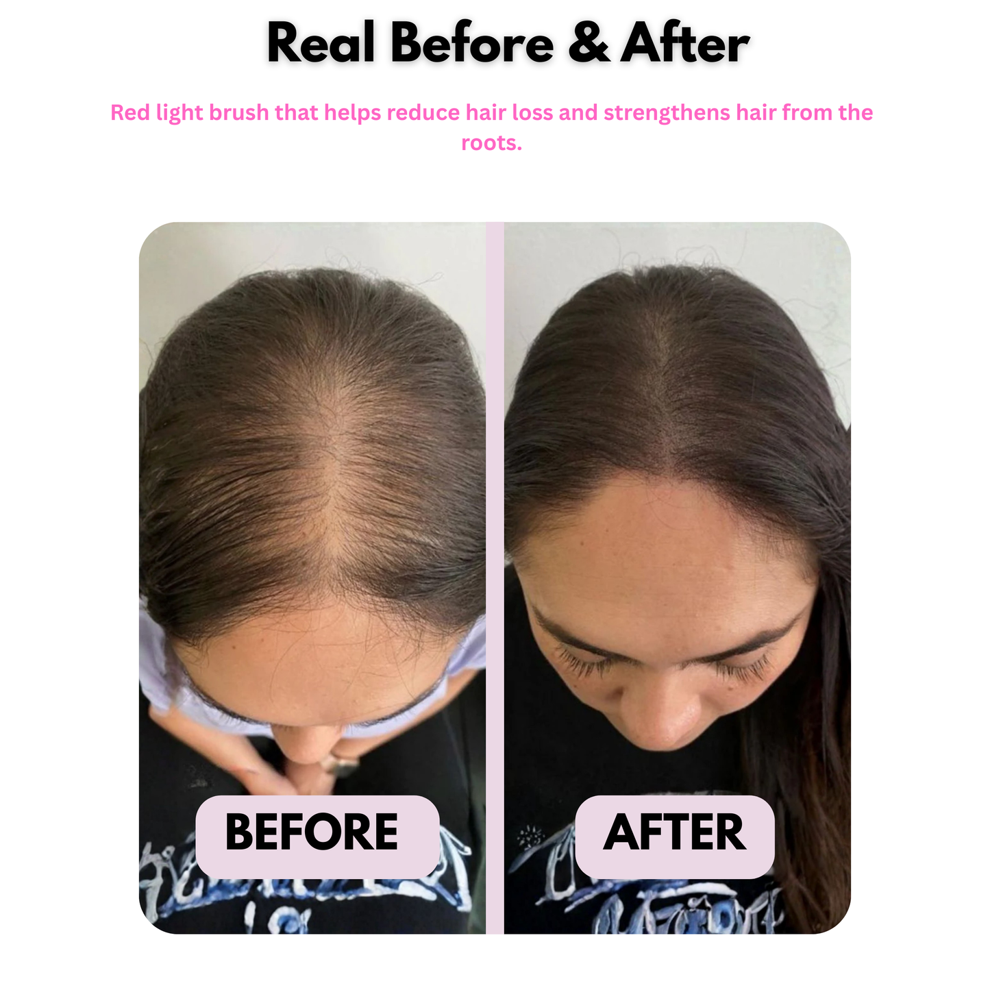 Electric Red Light Scalp Massager for Hair Growth & Scalp Care