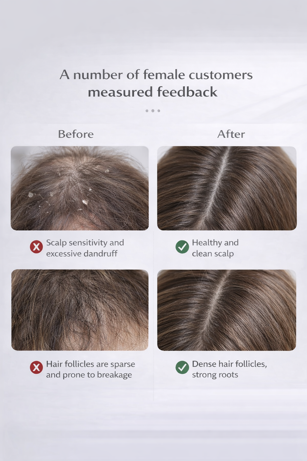 Electric Red Light Scalp Massager for Hair Growth & Scalp Care